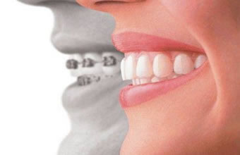 Orale Planos de Assistência Odontológica - Foto 1